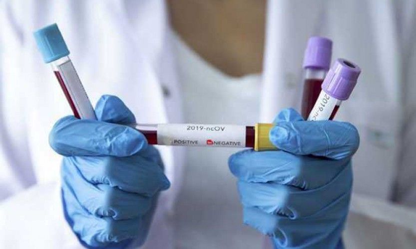 Résultat inverse : 1 "faux négatif"